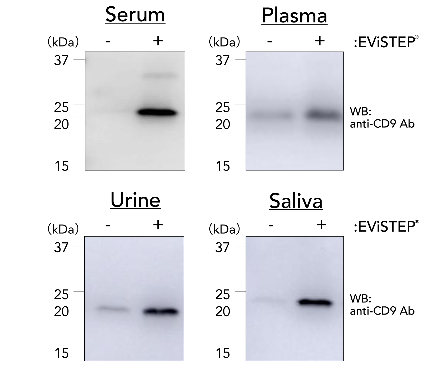 様々な検体種におけるEViSTEP®でのEVsの回収